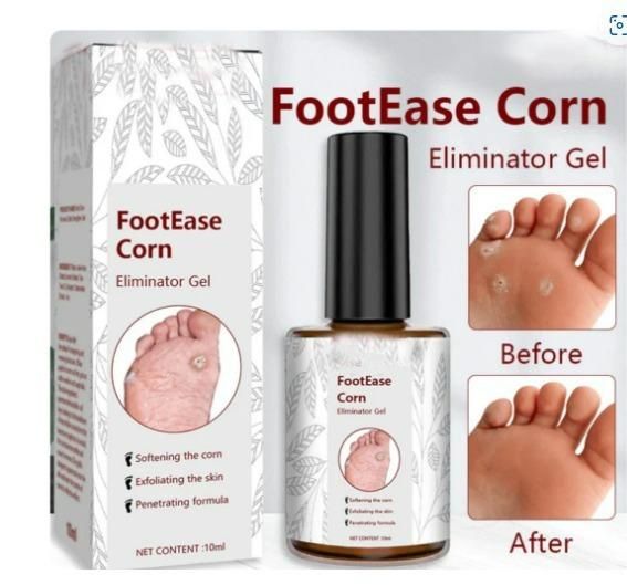 Feet Corn Removal Serum – 30 ml (Pack of 1)